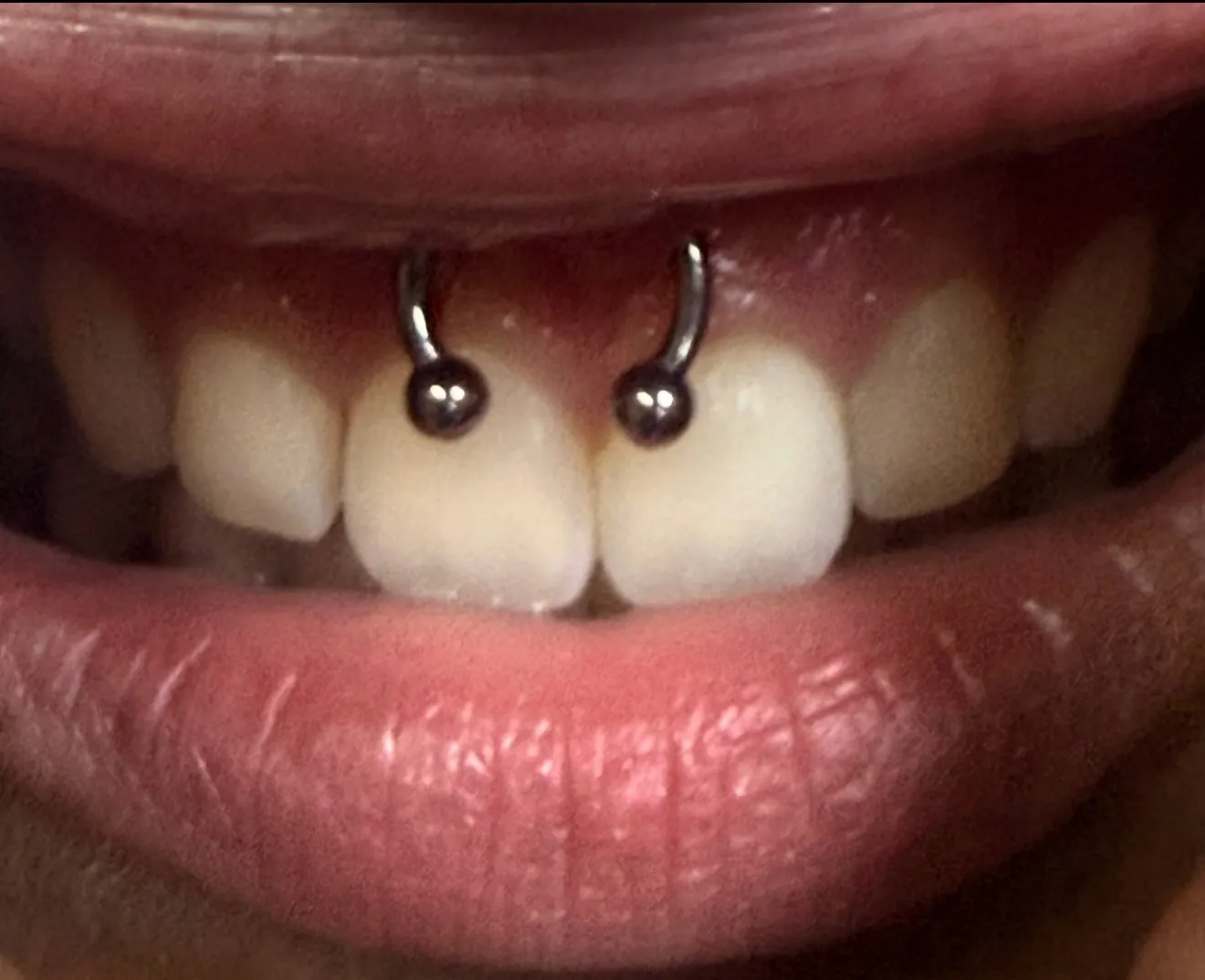Smiley piercing by Wheels at Golden Child Tattoo in Escondido