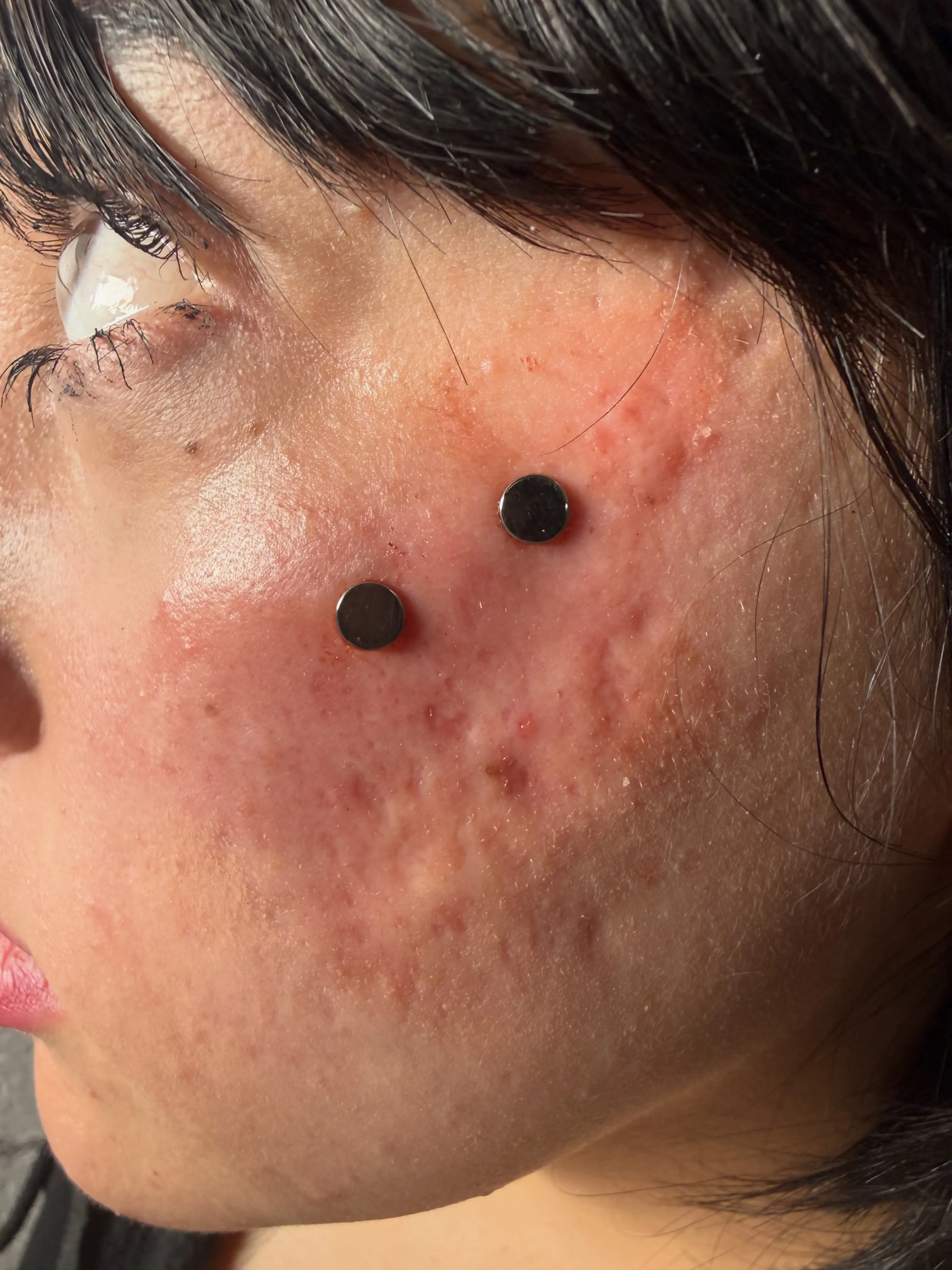 Anti-eyebrow surface piercing by Wheels at Golden Child Tattoo in Escondido