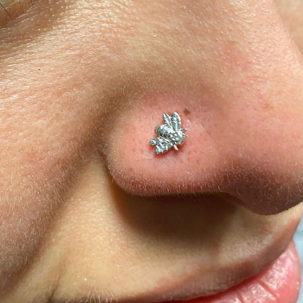 Why Cleaning Matters—Infection Risks & Healing Process